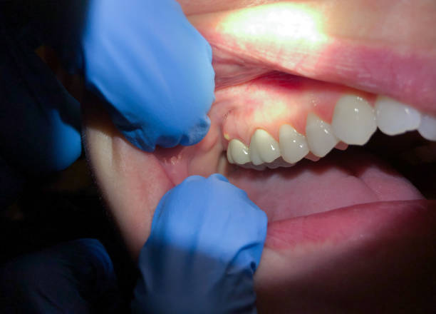 Best Broken Tooth Emergency  in Lyles, TN