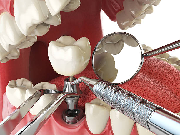 Best Emergency Tooth Extraction  in Lyles, TN